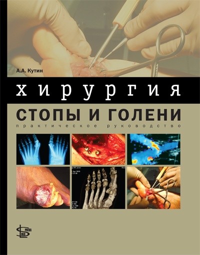 Хирургия стопы и голени