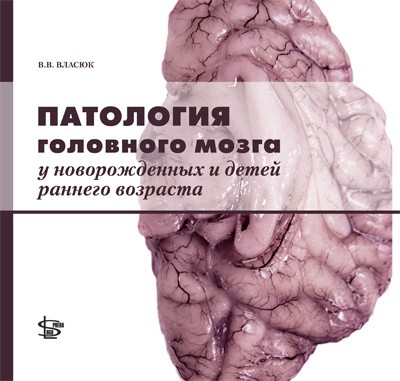 Патология головного мозга у новорожденных и детей раннего возраста