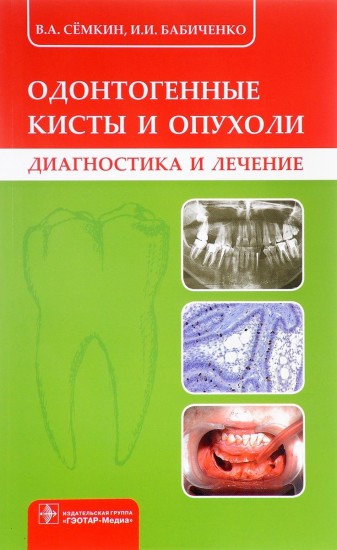 Одонтогенные кисты и опухоли