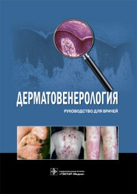 Дерматовенерология