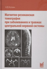 Магнитно-резонансная томография при заболеваниях и травмах
