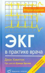 ЭКГ в практике врача