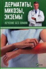 Дерматиты, микозы, экземы.