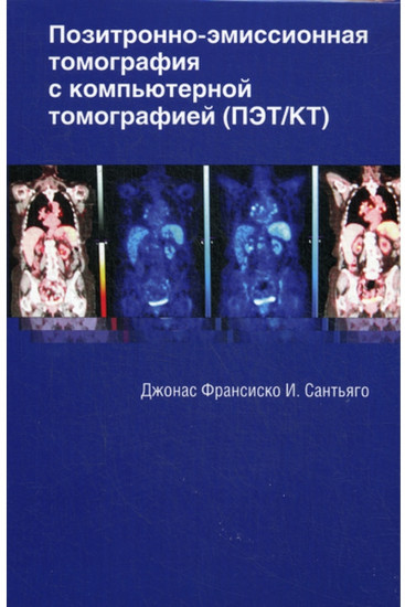 Позитронно-эмиссионная томография