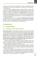 Клапанные пороки сердца - Фото 8