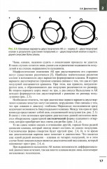 Клапанные пороки сердца - Фото 10