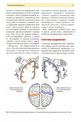 Нейропсихология в историях реальных больных - Фото 6