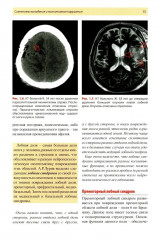 Нейропсихология в историях реальных больных - Фото 8