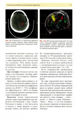 Нейропсихология в историях реальных больных - Фото 12