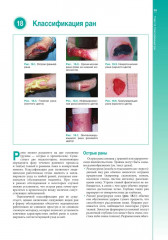 Наглядное пособие по лечению ран - Фото 12