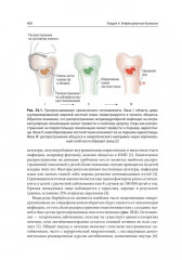 Доказательная скорая медицинская помощь: методы диагностики и правила принятия клинических решений - Фото 11