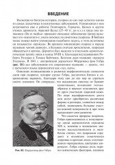 Псориаз. Диагностика, лечение и профилактика - Фото 2