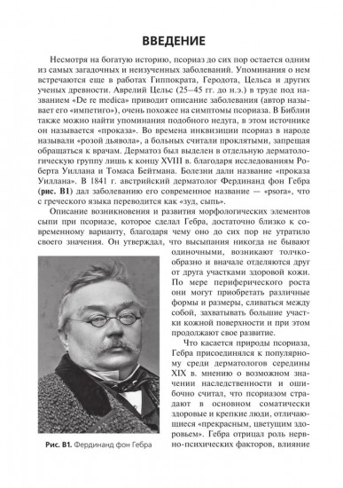 Псориаз. Диагностика, лечение и профилактика