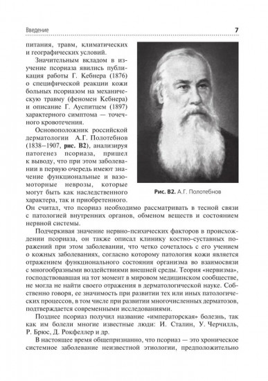 Псориаз. Диагностика, лечение и профилактика