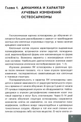 Лучевая терапия первичных злокачественных опухолей костей. Цитологические аспекты - Фото 2