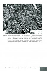 Лучевая терапия первичных злокачественных опухолей костей. Цитологические аспекты - Фото 4