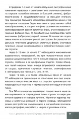 Лучевая терапия первичных злокачественных опухолей костей. Цитологические аспекты - Фото 10