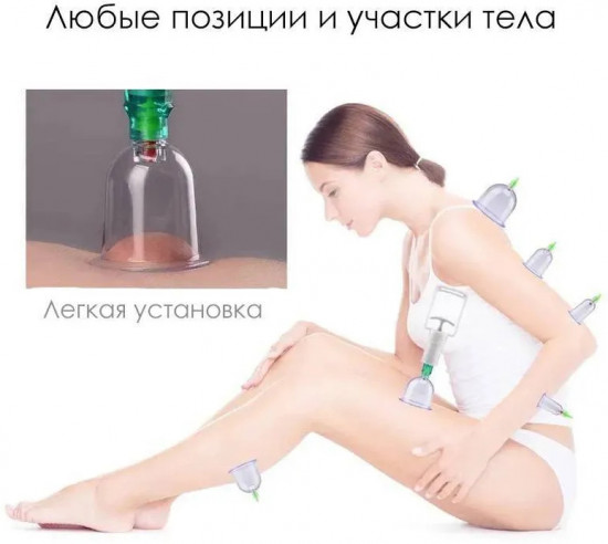 Массажные вакуумные банки для хиджамы с насосом