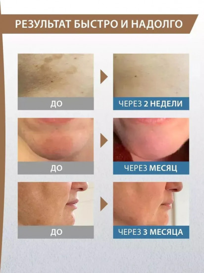 Концентрат для лица против пигментации