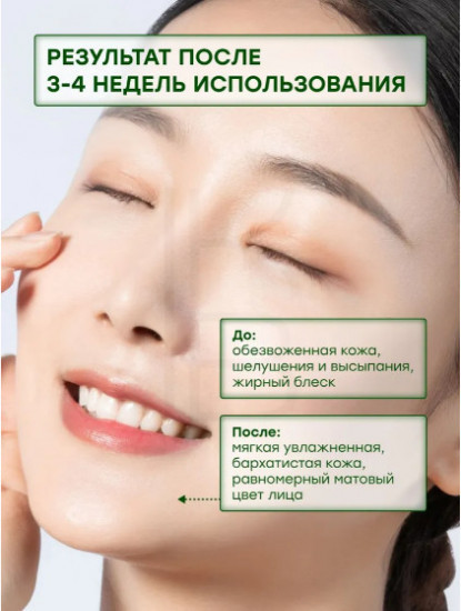 Крем с азелаиновой кислотой для проблемной кожи «A-Control Azelaic Acid Cream»