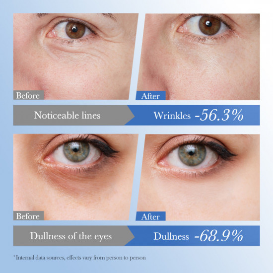 Крем для кожи вокруг глаз с икрой и гиалуроновой кислотой «Caviar Hyaluronic Acid Eye Cream»