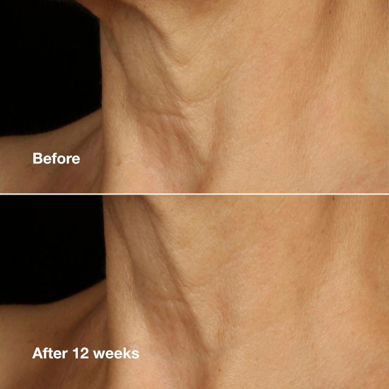 Крем для лица и шеи антивозрастной «Lifting Face + Neck Cream»