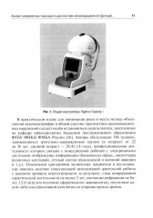 Аккомодационные нарушения в практике оптометрии и офтальмоэргономики - Фото 9
