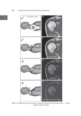 Лучшие практики МРТ-исследований - Фото 6