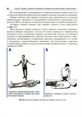 Практикум по первой помощи - Фото 8