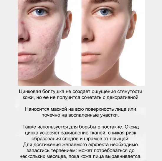 Болтушка для лица «Монастырская с цинком»