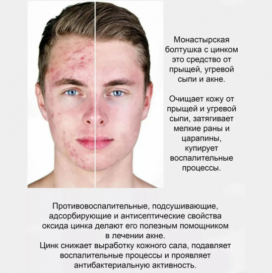 Болтушка для лица «Монастырская с цинком»
