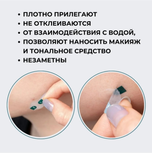 Водостойкие лечебные патчи для лица «Clean & Easy Blemish Spot Patch»