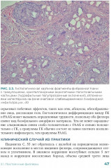 Постинъекционные осложнения в косметологии - Фото 15