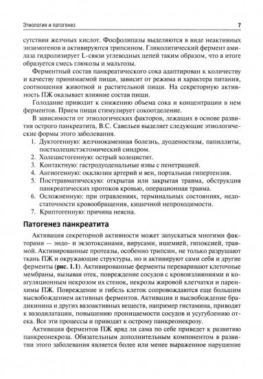 Острый панкреатит