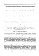 Острый панкреатит - Фото 4