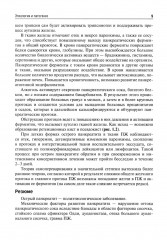 Острый панкреатит - Фото 5