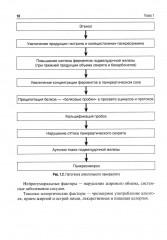 Острый панкреатит - Фото 6