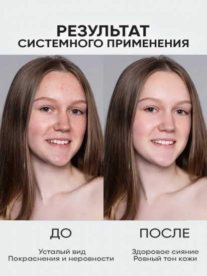 Тоник для лица «Увлажнение»