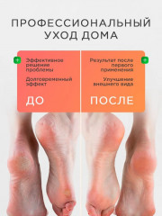 Маска-носочки отшелушивающая для ног - Фото 3