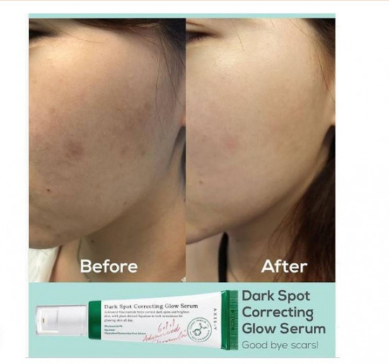 Сыворотка для лица корректирующая от темных пятен «Dark Spot Correcting Glow Serum»