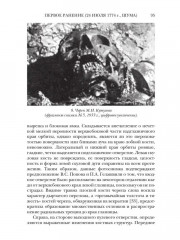 Ранения и смерть фельдмаршала Кутузова - Фото 7