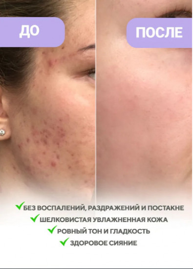 Крем для лица с ресвератролом восстанавливающий «Resveratrol 345 NA Intensive Repair Cream»