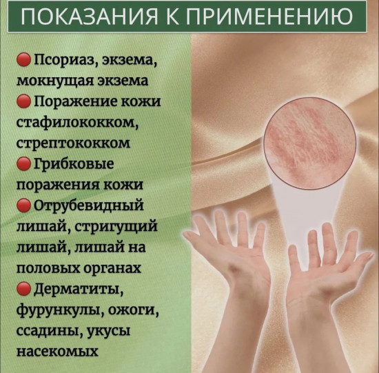 Мазь от псориаза и укусов «Линчжи»