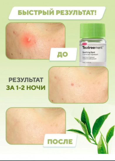 Лечебная точечная сыворотка «Teatreement Soothing Spot»