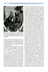 Компьютерная томография в гастроэнтерологии - Фото 10
