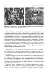 Боли в поясничной области - Фото 8