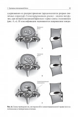Боли в поясничной области - Фото 9