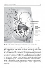 Боли в поясничной области - Фото 10