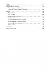 Розацеа - Фото 2