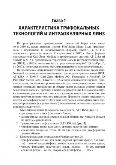 Методика интраокулярной коррекции пресбиопии трифокальными интраокулярными линзами